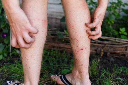 It can be infected after 10 seconds of contact, and the Chinese disease control will remind you repeatedly.